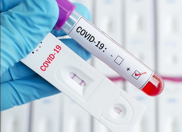 801 нови случая на COVID 19 са регистрирани у нас за